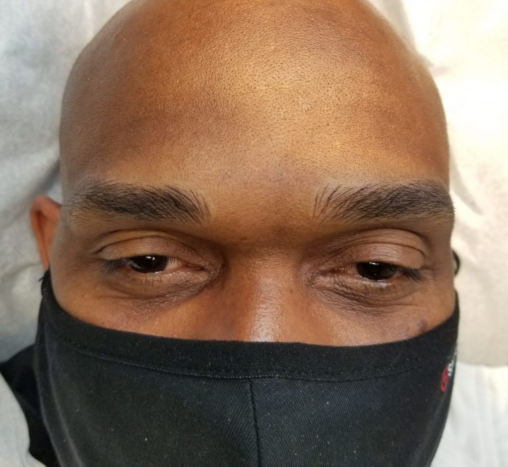man with eyebrow microblading wearing a mask