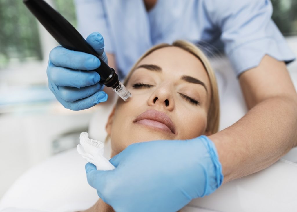 facial microneedling